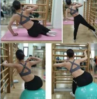 脊柱側(cè)彎鍛煉