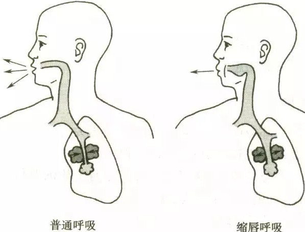 脊柱側(cè)彎的呼吸加支具