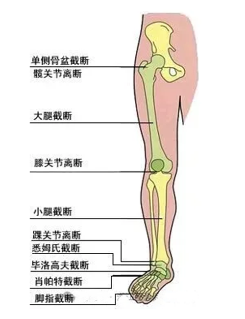 下肢截肢部位名稱