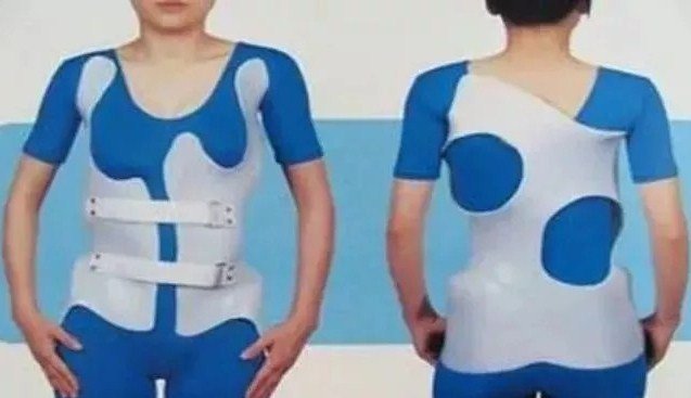 脊柱側(cè)彎早發(fā)現(xiàn)，早治療