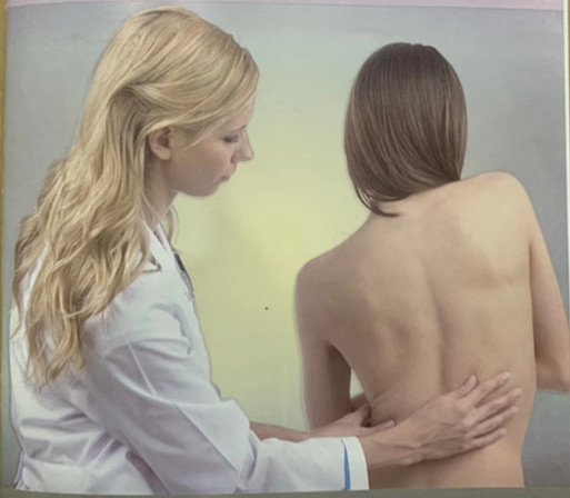 脊柱側(cè)彎早發(fā)現(xiàn)，早治療