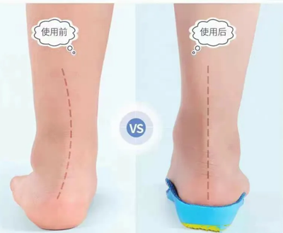 扁平足鞋墊 