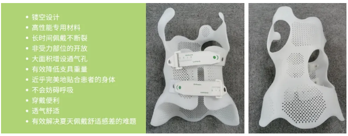 傳統(tǒng)脊柱側(cè)彎支具與3D打印矯形支具的區(qū)別  