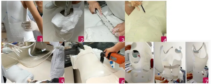 傳統(tǒng)脊柱側(cè)彎支具與3D打印矯形支具的區(qū)別  